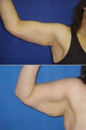 0f8b53f6616a7d615c59e8d2cc9de3c4