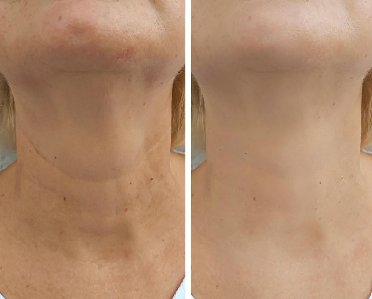 49e8d7cdfdd4f65cdd0ea2ecfffa2e6d