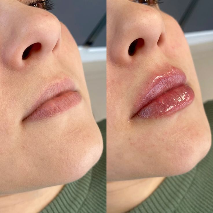 7303bb1093a25a8d522e74e528b45f2b