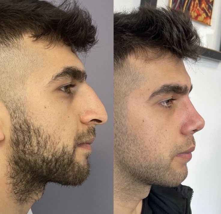 737d67550d857da69538809415823671