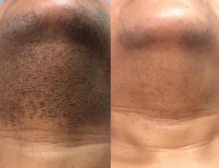 9648c49841d459b650eadcfd764022e4