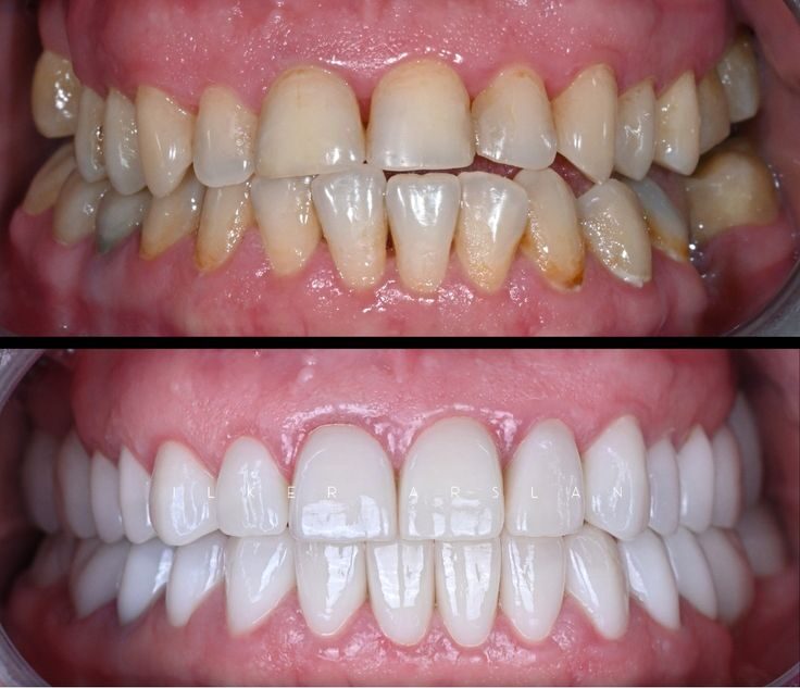 999f7f46715d0345e89ac93aa68efbbd