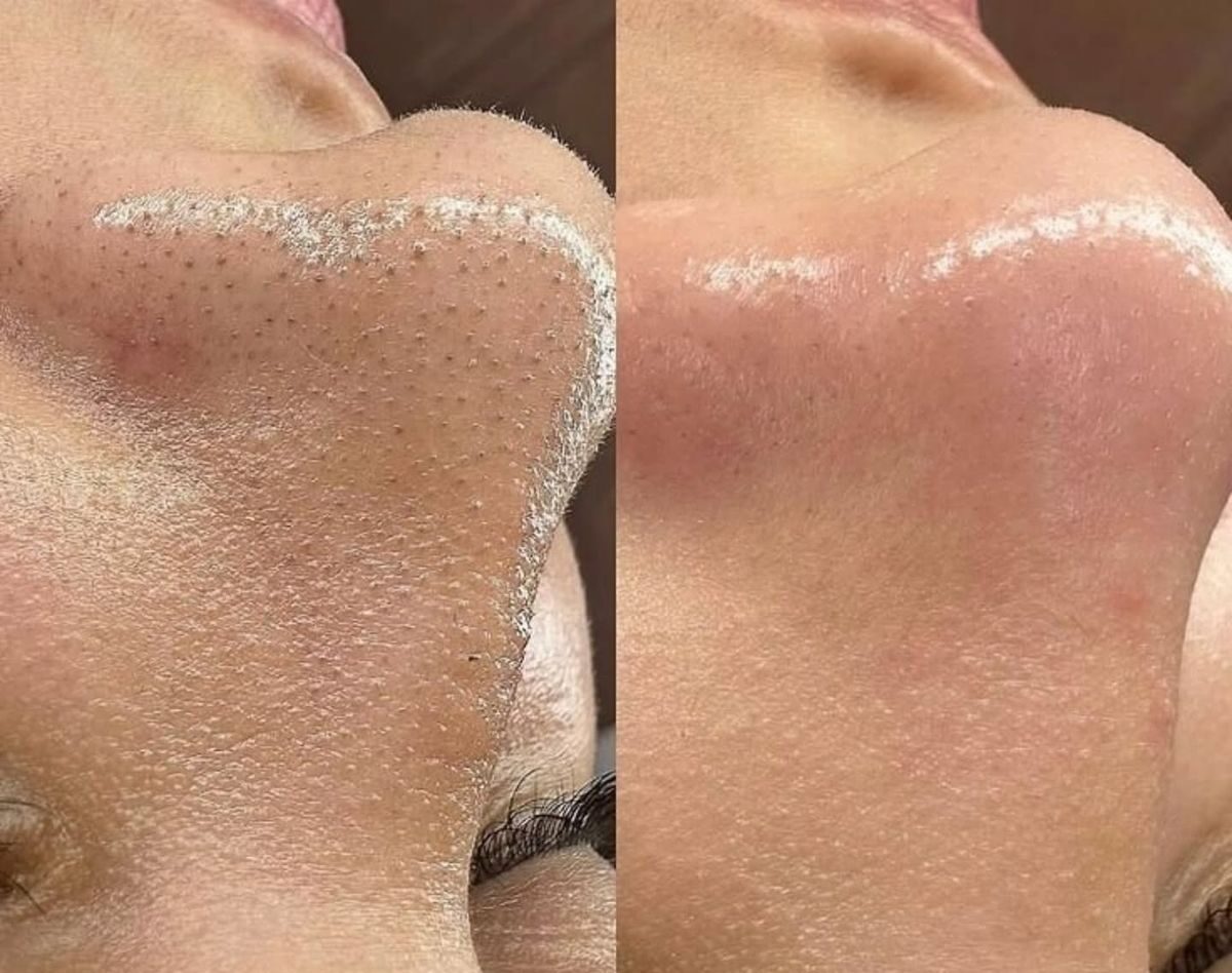 a1e0605f3b8bd1c082302f65f6fdca7f