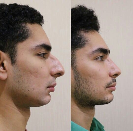 a9553e8e92c6f392df5958ed404dce80