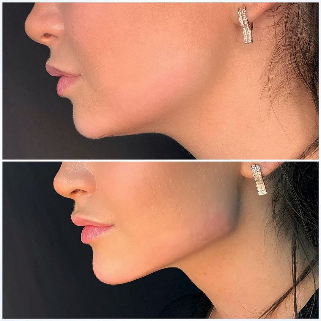 c29f26c35413d50bb85a7c82136b92f3