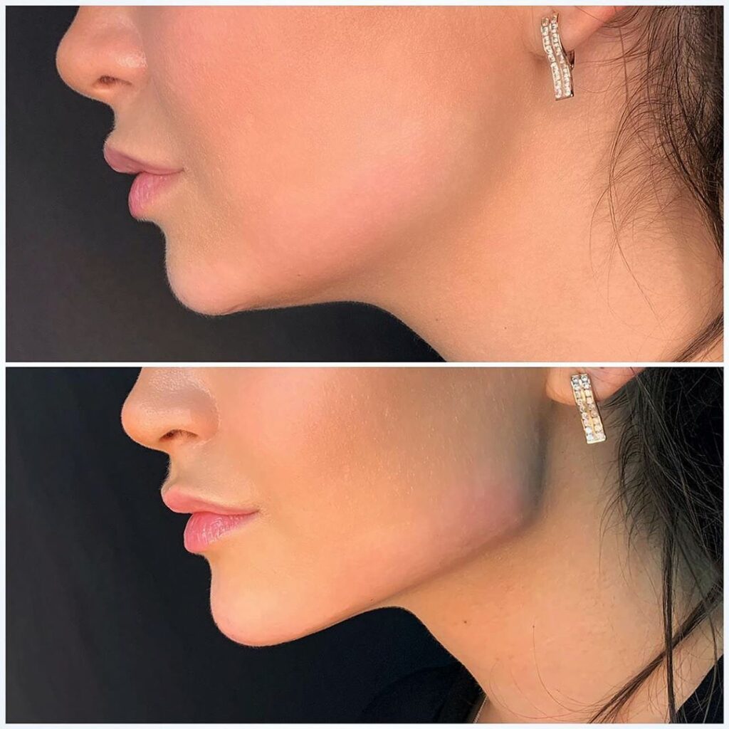 c29f26c35413d50bb85a7c82136b92f3